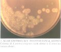listeria1.jpg (3357 bytes)