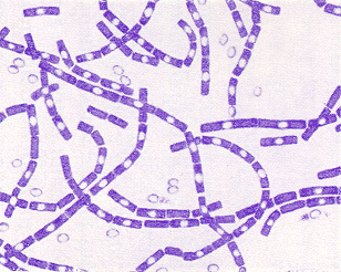 spore.jpg (64052 bytes)