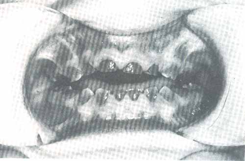 dentinog.jpg (22603 bytes)
