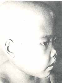 thalassemia.jpg (9705 bytes)