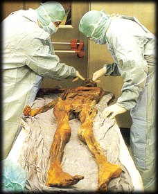 otzi med