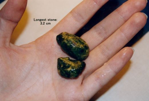 pedras1
