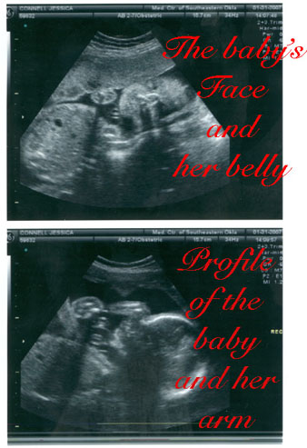 Monika's First Picture