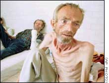 "Detainee" at Trnopolje death camp