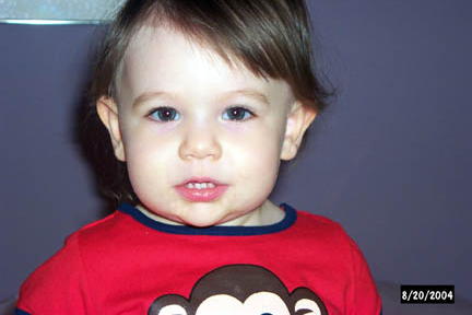 Monkey girl