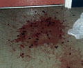 Whose puke is that?