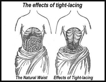 corset.jpg (27703 bytes)