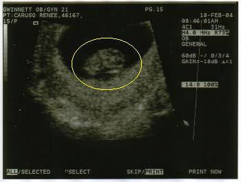 Looks just like Daddy