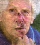Elsie Patterson, seriously injured due to Shitty Vision's incompetence.
Photo by Jason Oxenham, Harbour News.