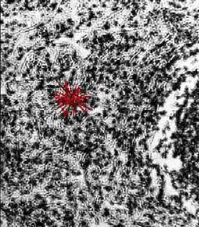 pulnode.jpg