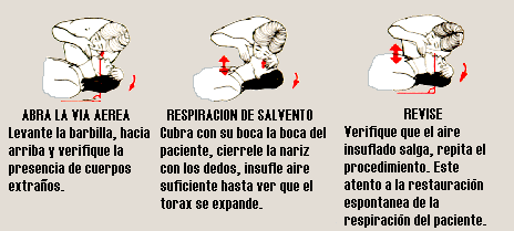 Respiraci�n de Salvamento