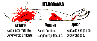 Clasificaci�n de las Hemorragias