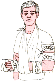 Inmovilizaci�n de brazo