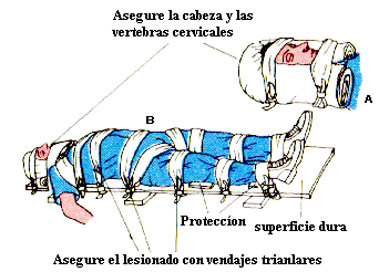 Inmovilizaci�n de Columna