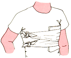 Inmovilizaci�n de Costillas