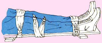 Inmovilizaci�n de pierna