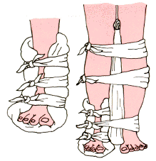 Inmovilizaci�n de Tobillo