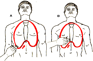 Compresi�n Card�aca Externa