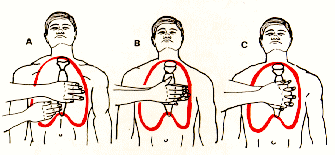 Compresi�n Card�aca Externa