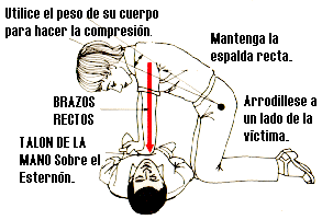 Compresi�n Card�aca Externa