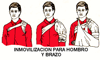inmovilizaci�n hombro - brazo