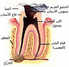 Tooth