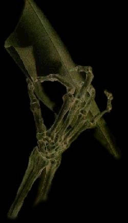 skeletal hand