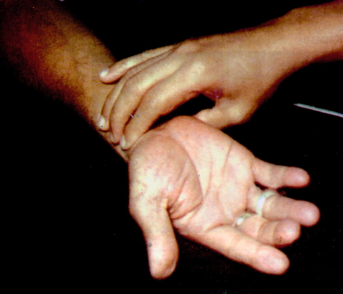 Diagnos Punca Penyakit Melalui Palpitasi Nadi