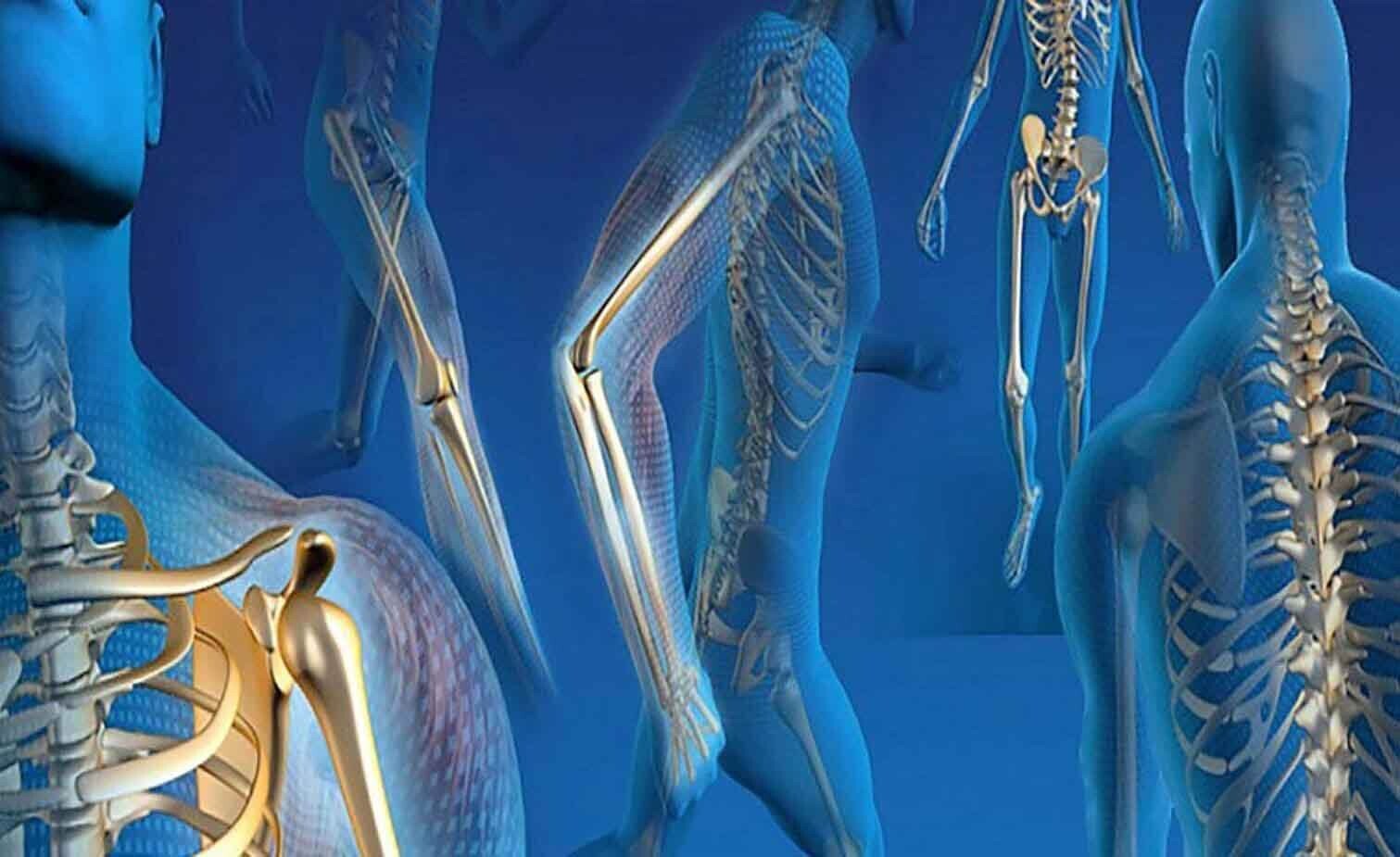 Trauma Implants