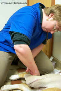 acupuncture treatments