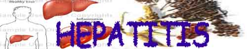 Alternative Medicine Acupuncture Herbal Treatment Cure Hepatitis Medical Treatment Cure Centre