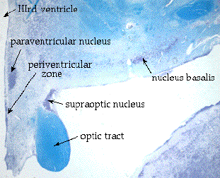 hypo2.gif (29057 bytes)