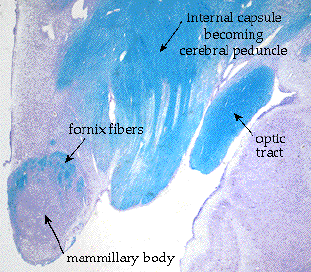 hypo4.gif (39291 bytes)