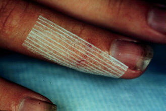 Society's cruelest cut?