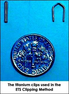 Grapas de titanio