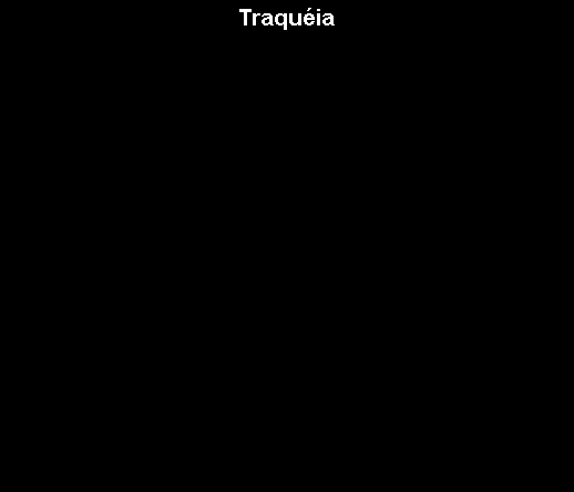 Caixa de texto: Traqu�ia