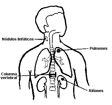 ORGANOS AFECTADOS