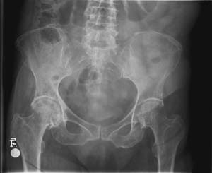 pelvis.JPG (10065 bytes)