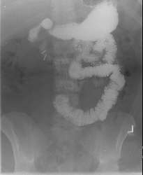 SBFT image