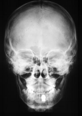 skull.gif (99370 bytes)