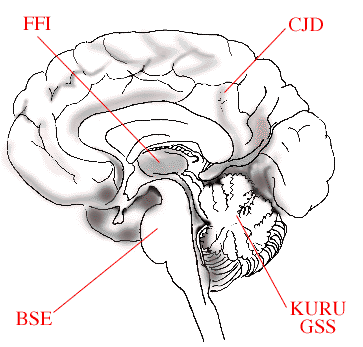 Right half of the brain: Midsagittal section
