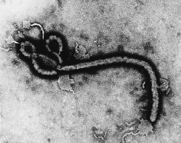 VIRUS EBOLA AL MICROSCOPIO ELCTRONICO