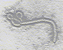 VIRUS EBOLA
