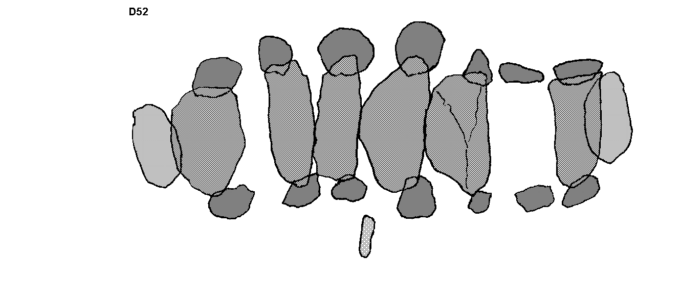 Hunebed D52 bij Diever (Hezen-es), Gemeente Diever / Gro�steingrab D52 bei Diever, Gemeinde Diever / All�e couverte D52 chez Diever, commune de Diever / Tumba megal�tica D52 cerca de Diever, municipio de Diever