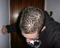 Jon..? Are those... bald spots?