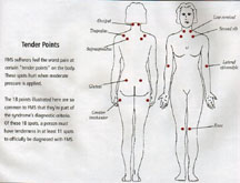 General tenderpoint locations