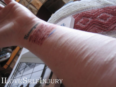 My Arm