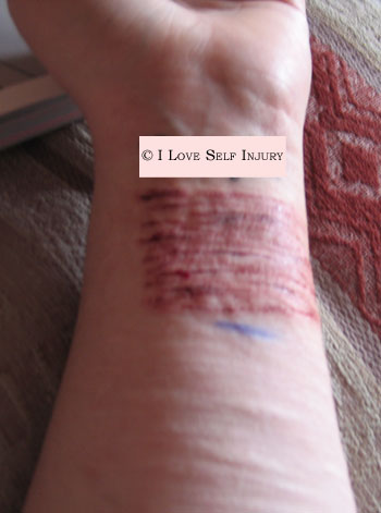 My cuts