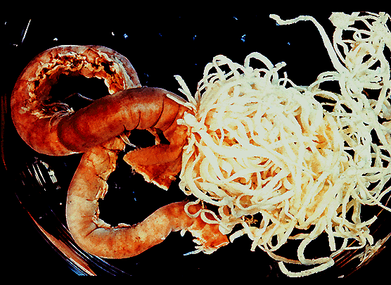 Intestinal Blockage (click to go back)
