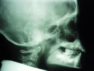 My head